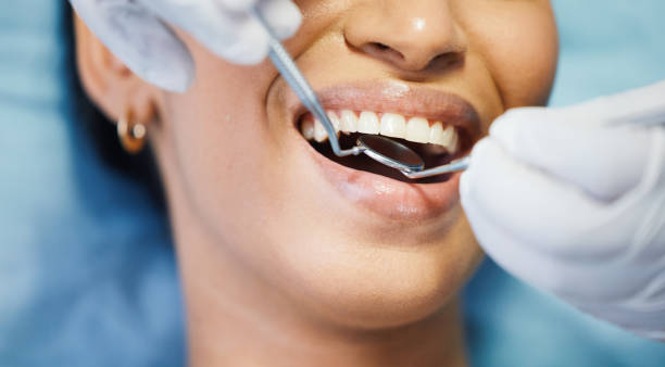 Best Emergency Tooth Extraction in Sturgeon, PA
